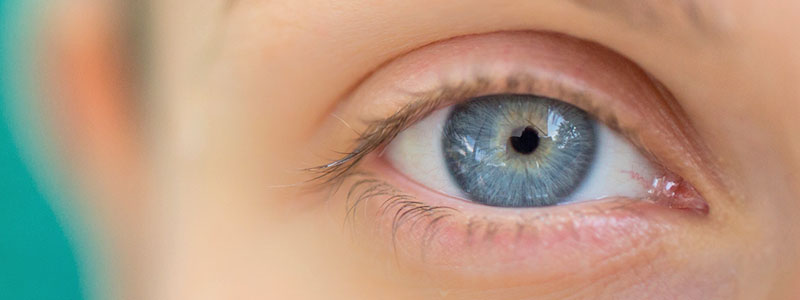 eyes-eye-conditions-s1